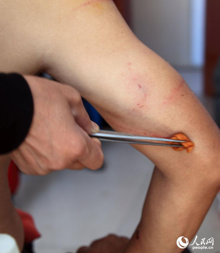 ??? ???? ?? ? ??? ??? ?? ??