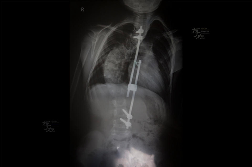 ??? ??? ????? ??, ???? ????