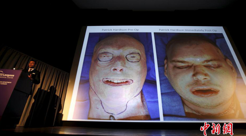 ??大, ???? ?? ??? ?? ?? ?? ??