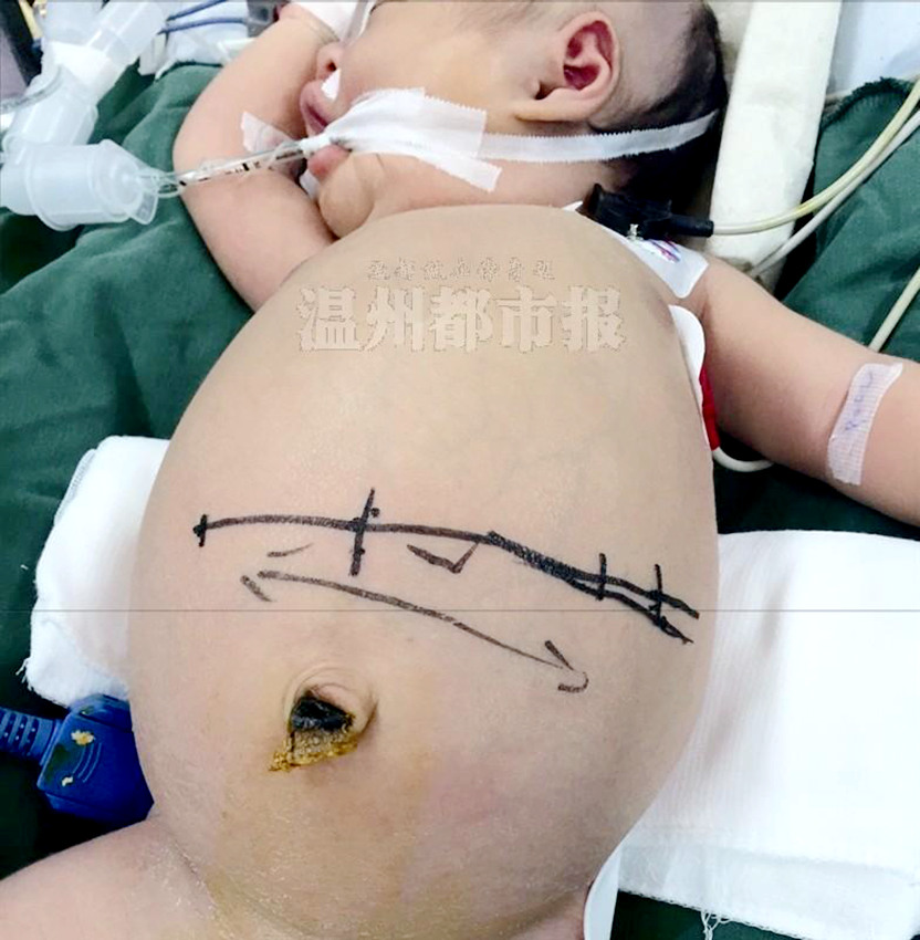 ?! ?? 9? ? ?? ???? ‘????’ ??