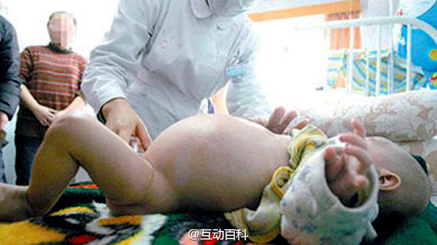 ?! ?? 9? ? ?? ???? ‘????’ ??