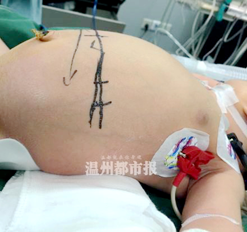 ?! ?? 9? ? ?? ???? ‘????’ ??