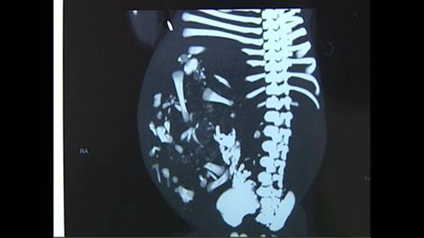 ?! ?? 9? ? ?? ???? ‘????’ ??