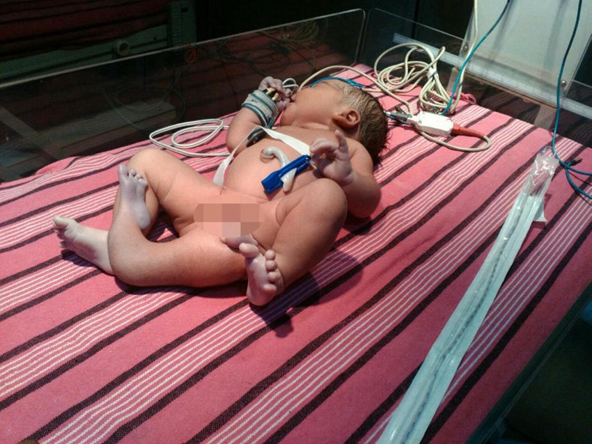 ??? ?? ??! ?? ?? 3? ??? ??? ??, ?? ???