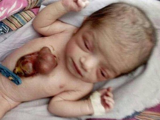 印: ??? ?? ?? ?? ??? ??, ???? 50%