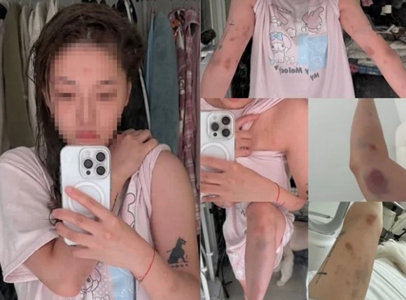 ?? ???? ?? ???? ??? ????? ???? ??? ????. [?? ??: ??? SNS ??]